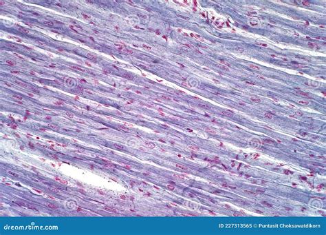 Human Cardiac Muscle Under The Microscope Stock Photography