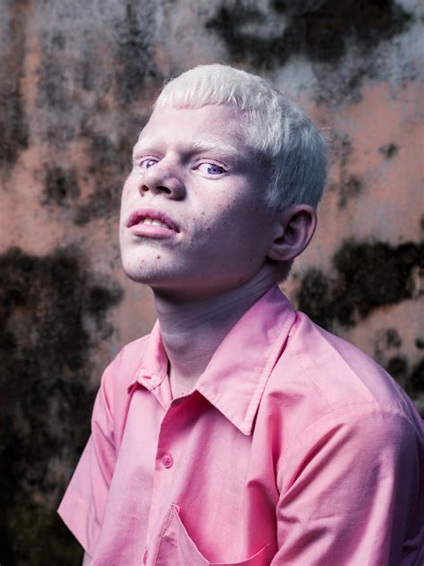 Indian Boys With Albinism — Brent Stirton