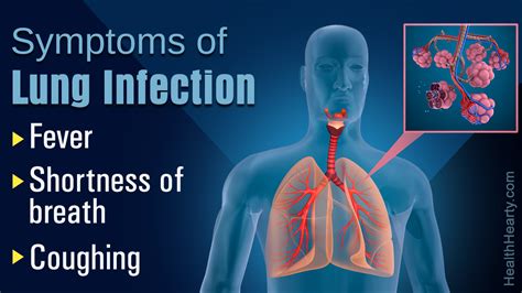Severe Recurrent Lung Infections Pictures