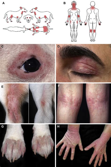 What Can We Learn From Treating Atopic Itch In Dogs Journal Of