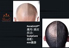 美職人 - ShineE 孕髮流程:客戶諮詢，頭皮檢查，判斷療程是否適合-平衡油脂分泌消炎頭皮-注入ShineE...