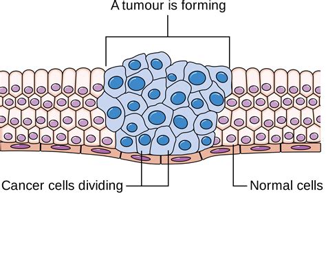 6 Differences Between Cancer Cells And Normal Cells Y