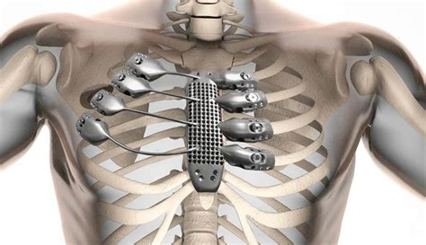 Worlds First 3d Printed Breathing Organ Could Help End The Organ