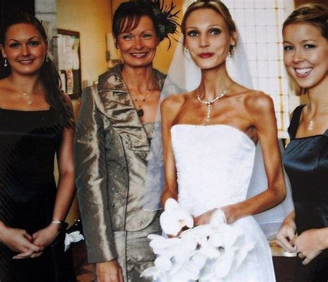 Astonishing Recovery From Anorexia 13 Pics