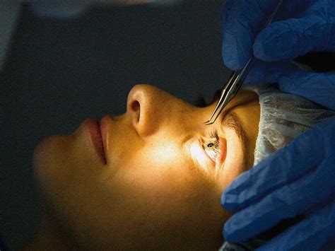 9 Facts About Lasik Eye Surgery Explained In Detail Nikon Lenswear