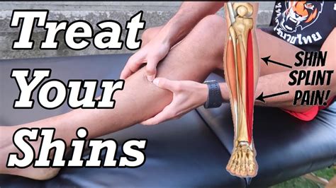 Shin Splint Exercises Treatment Protocol Youtube