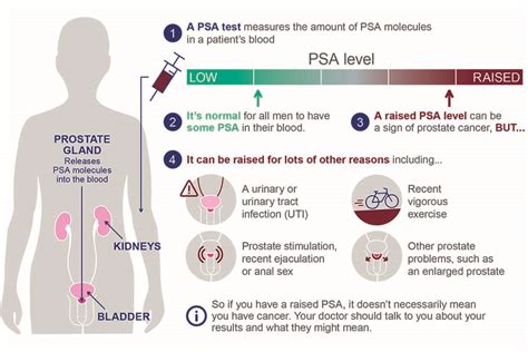 Prostate Cancer PSA Levels Chart