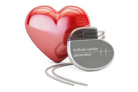 Implantable Device Insertion Pacemaker Defibrillator Loop Recorder
