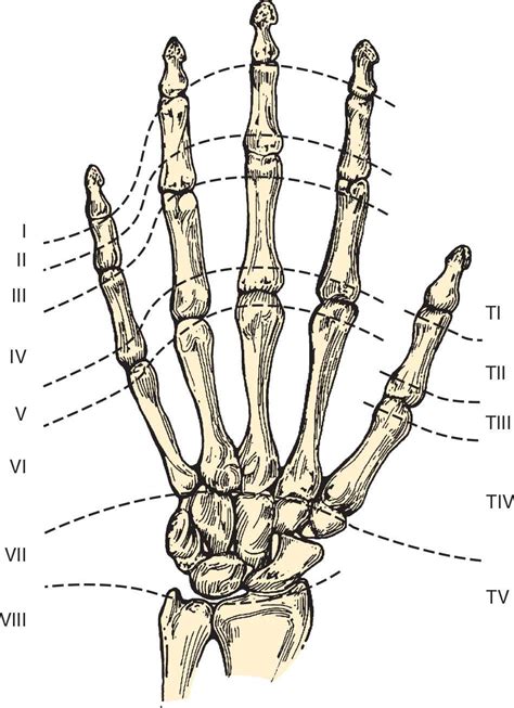 See wrist tendonitis stock video clips. Extensor Tendon Repair | Anesthesia Key