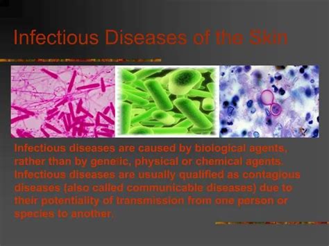 Ppt Infectious Diseases Of The Skin Powerpoint Presentation Free
