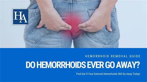 Carolcdesign What Do External Hemorrhoids Look Like