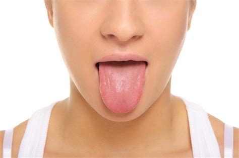 Things To Know About Geographic Tongue Facty Health