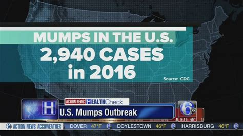 Growing Outbreak Of Mumps In Us 6abc Philadelphia