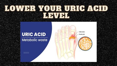 Mastering Uric Acid Effective Methods To Lower Your Levels Youtube