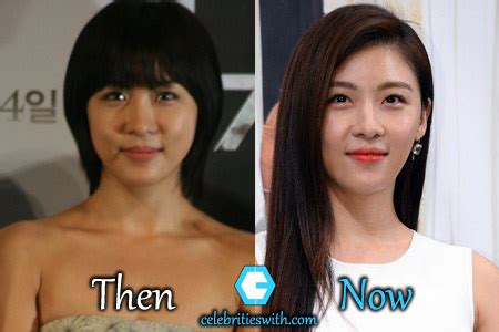Ha Ji Won Plastic Surgery Nose Job Eyelid Surgery Before After Pics