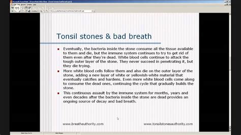 Bad Breath Tonsil Stones Tonsil Stones Cause 2019 Youtube