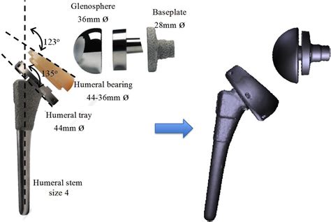 Effects Of The Humeral Tray Component Positioning For Onlay Reverse