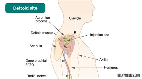 Intramuscular Injection Im Osce Guide Im Injection Geeky Medics