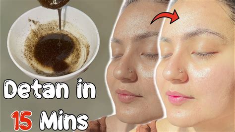 Remove Sun-Tan Instantly : ये Remedy जिद्दी से जिद्दी Sun Tan को 15