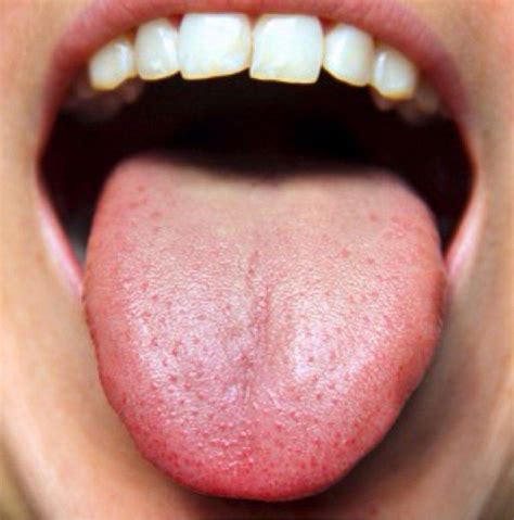 You Cant Ignore These Things Your Tongue Is Warning You About