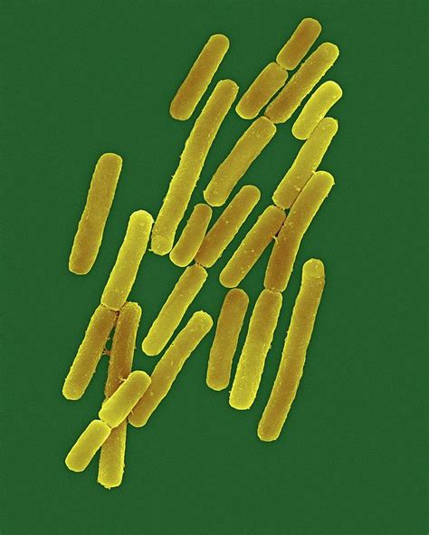 Clostridium Difficile Photograph By Dennis Kunkel Microscopyscience