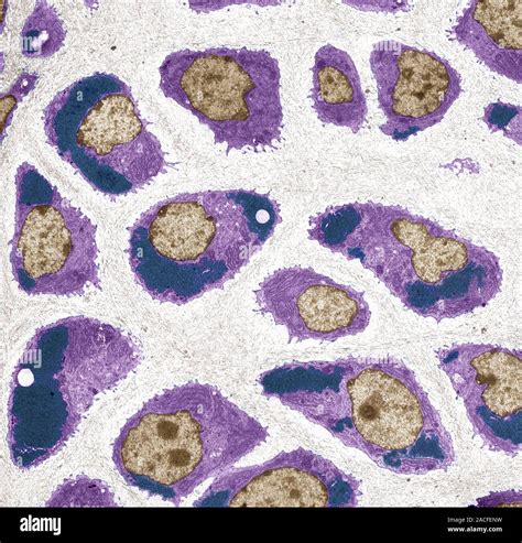 Cartilage Cells Coloured Transmission Electron Micrograph TEM Of A