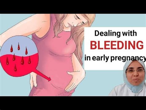 Bleeding In Early Pregnancy Does Bleeding Always Mean Miscarriage Youtube