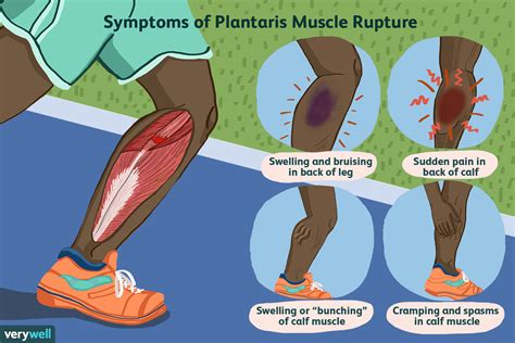 Upper Leg Muscles And Tendons The Muscle Ends In Tendons And The