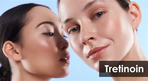 Witness The Transformation Hyperpigmentation Tretinoin Before And After