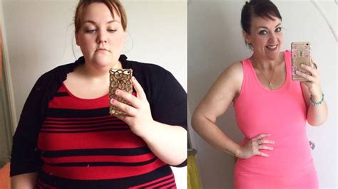 Ontario Woman Drops Over 200 Lbs Following Gastric Bypass Surgery