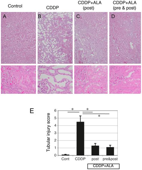 Information and guidance for renal professionals. Renal histopathology and scores for characteristic ...