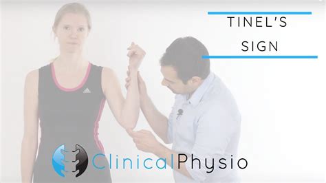 Tinels Test For Cubital Tunnel Syndrome Clinical Physio Youtube