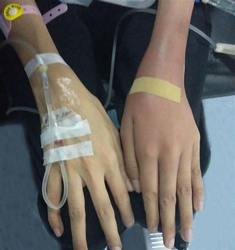 Initial Clinical Photograph Showed Swelling And Erythema Over The Left