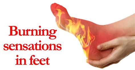 Burning Feet 20 Causes Diagnosis Home Remedies And Treatment Health Healer