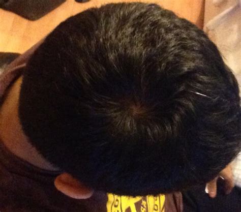 493 best hair swirl free brush downloads from the brusheezy community. My hair swirl is getting bigger?. Thread discussing My ...