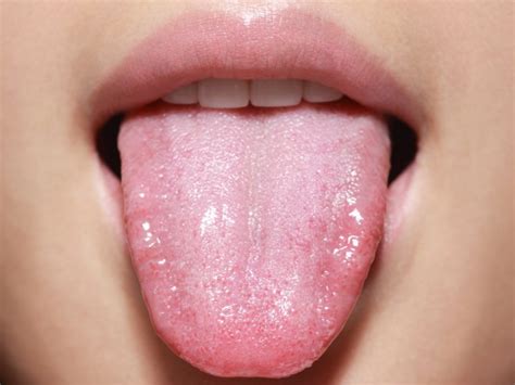 What your tongue can tell you about your health - Chatelaine