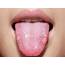 What Your Tongue Can Tell You About Health  Chatelaine