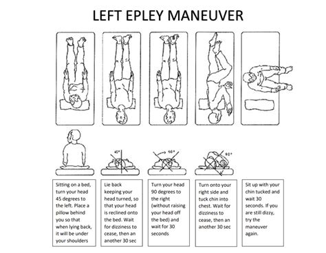 Epley Maneuver Exercises Home Pdf Brandt Daroff Exercise For Vertigo