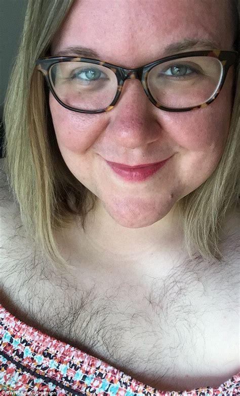 Woman With Excessive Body Hair Decides To Embrace Her Natural Look
