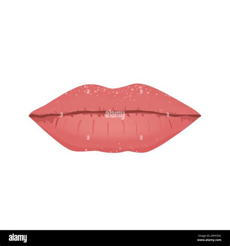 Fordyce Spots On Female Lips Isolated Vector Illustration Fordyce