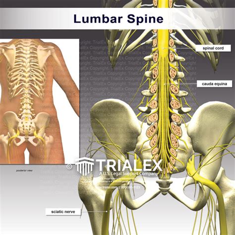 Lumbar Spine Trialexhibits Inc