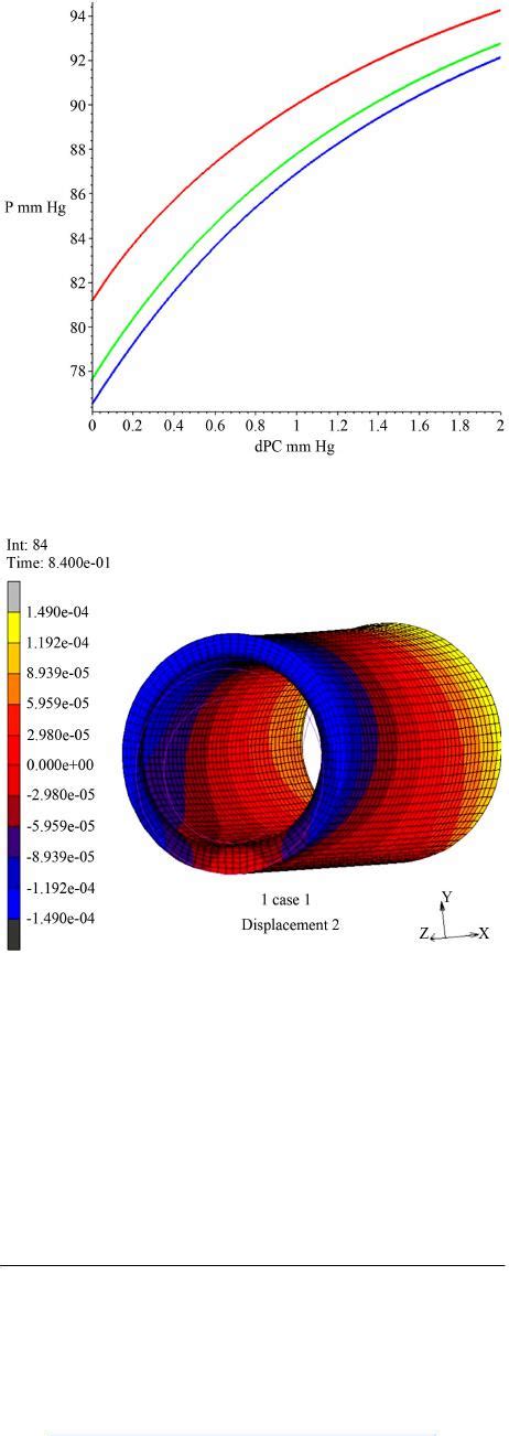 Towards Simulation Of Germinal Matrix Hemorrhage As A