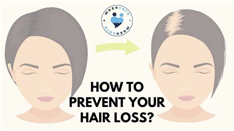 How To Prevent Your Hair Loss Mozocare Insights Find Healthcare Abroad