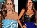 Sofia Vergara Breast Implants Plastic Surgery Before And After Boobs Job
