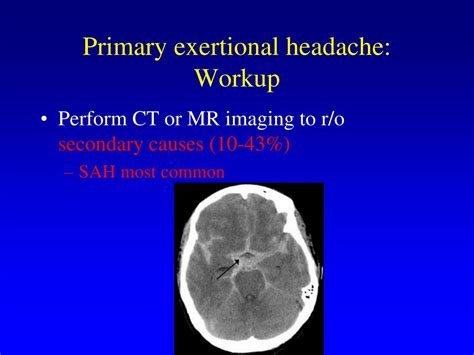 Ppt Headache In Athletes March 2011 Powerpoint Presentation Free