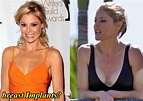 Celebrity Before and After Plastic Surgery - Julie Bowen Plastic ...