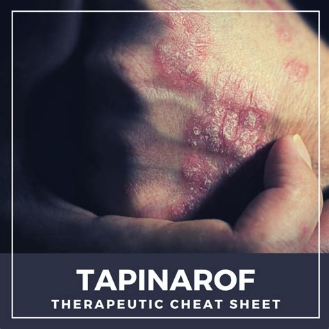 Tapinarof Therapeutic Cheat Sheet Next Steps In Dermatology