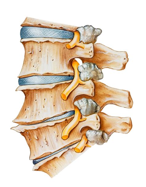 Facet Joint And Bone Treatment South Plainfield Nj Bct Medical