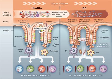 Microbial Signatures Of A Healthy Gut And Ibd Under Healthy