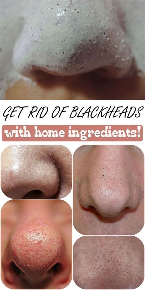 Pin On Face Scrub For Blackheads